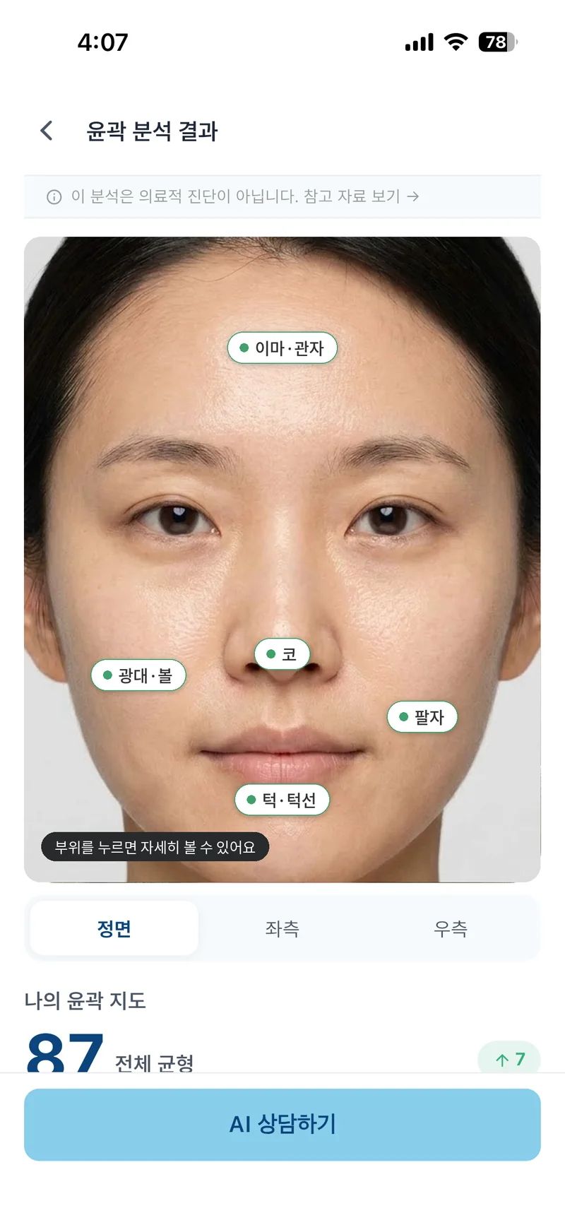 SkiNote 윤곽 분석 결과 화면 — 부위별 점수와 균형 잡힌 부위