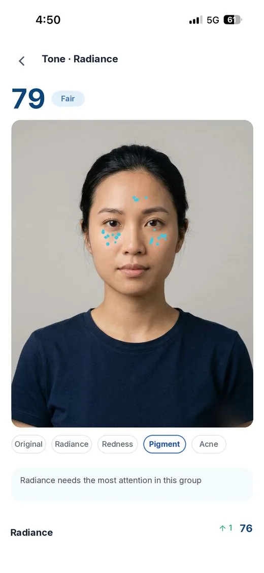 AI analysis with pigmentation markers mapped on the face