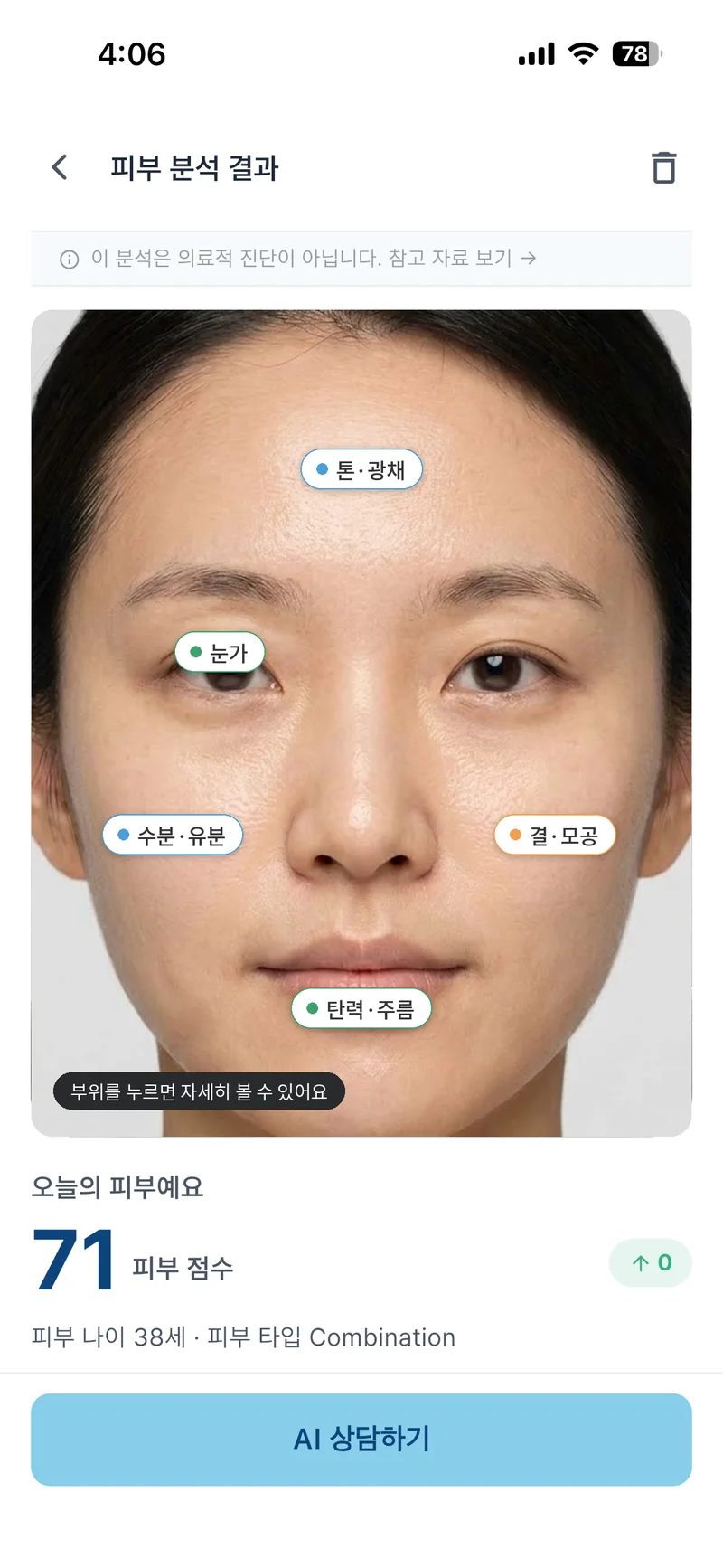 SkiNote 피부 분석 결과 화면 — 피부 점수 71점과 부위별 분석